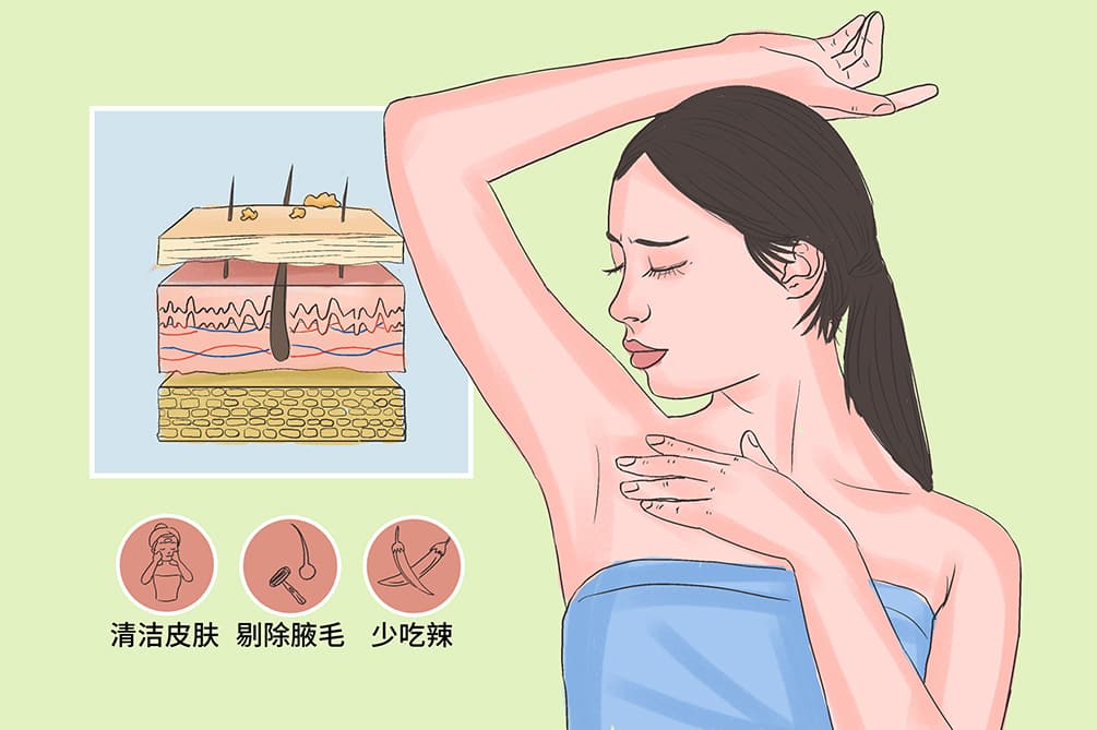 孕妇有腋臭可以用什么方法去除
