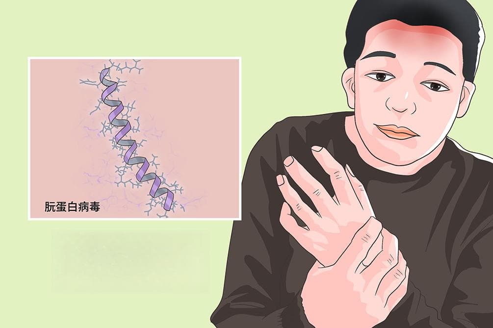 库鲁病：一种致命的海绵状脑病