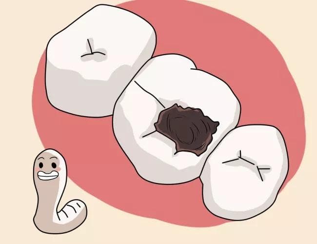 龋齿好好刷还会恶化吗？黑色龋齿是静止龋吗？