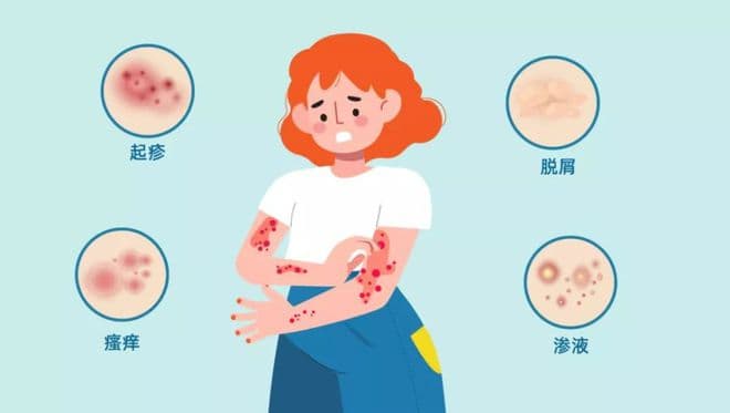 冬季痒越抓越痒是怎么回事？专家教你3招告别冬季皮肤瘙痒