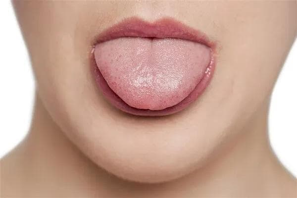 大人的舌头厚白是什么回事