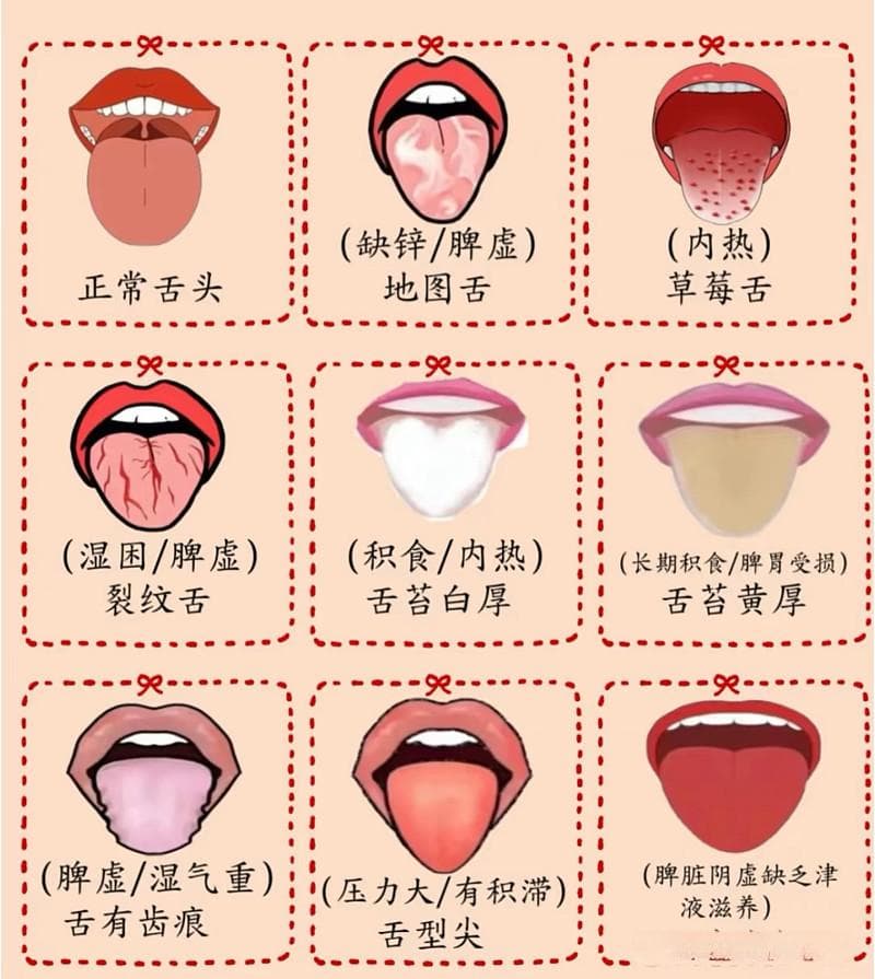 五脏好不好，看看舌头就知道