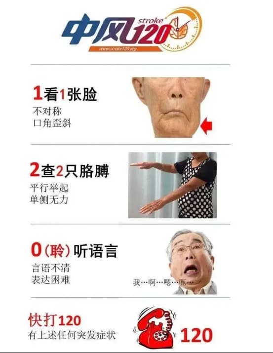 脑梗塞与视力模糊：一个不容忽视的健康警讯