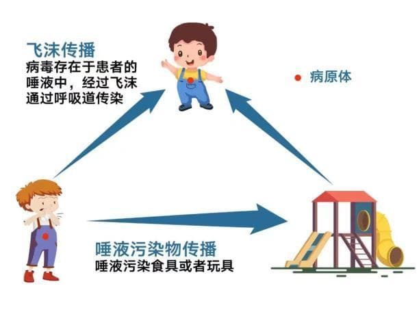 孩子腮帮鼓鼓，警惕“流腮”