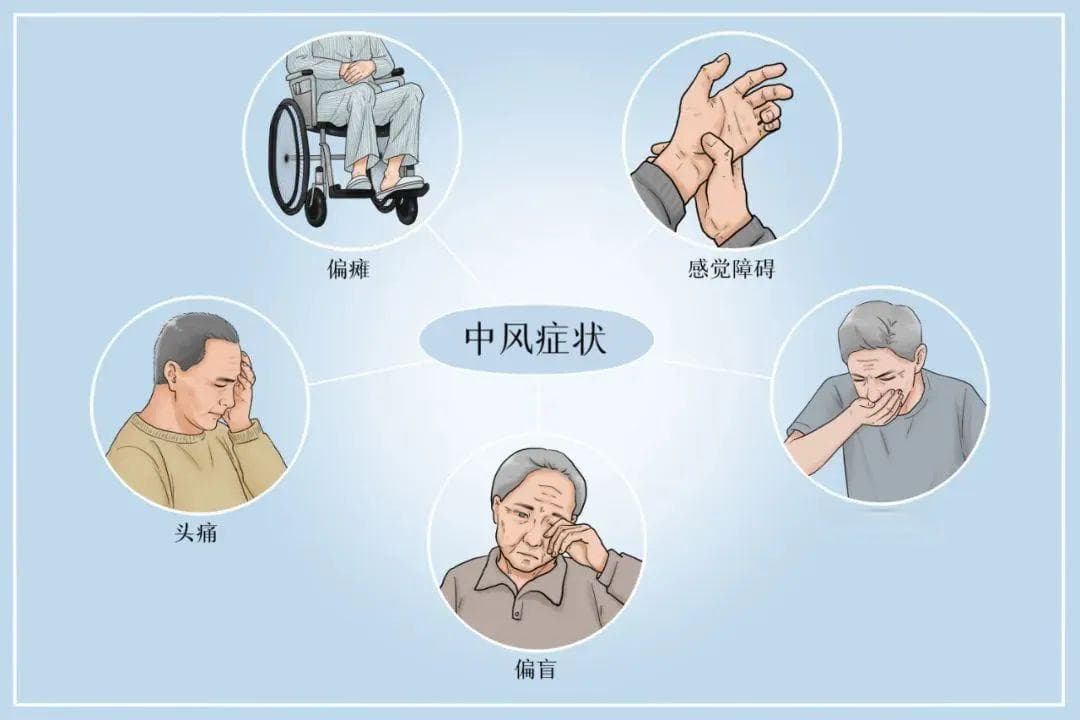 睡前有这5种表现，可能是脑梗