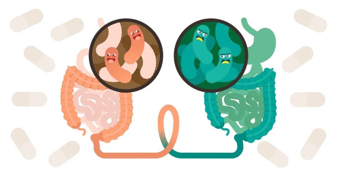 Nature子刊：移植瘦子的肠道菌群，能够改善肥胖患者健康