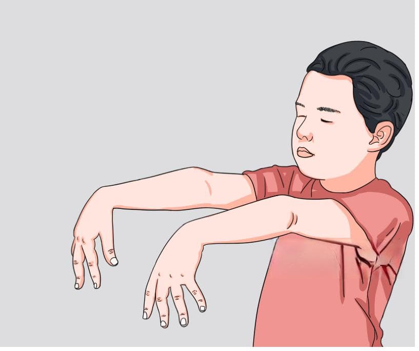 为什么会梦游是什么原因