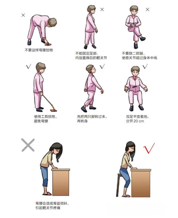 髋关节保养“说明书”