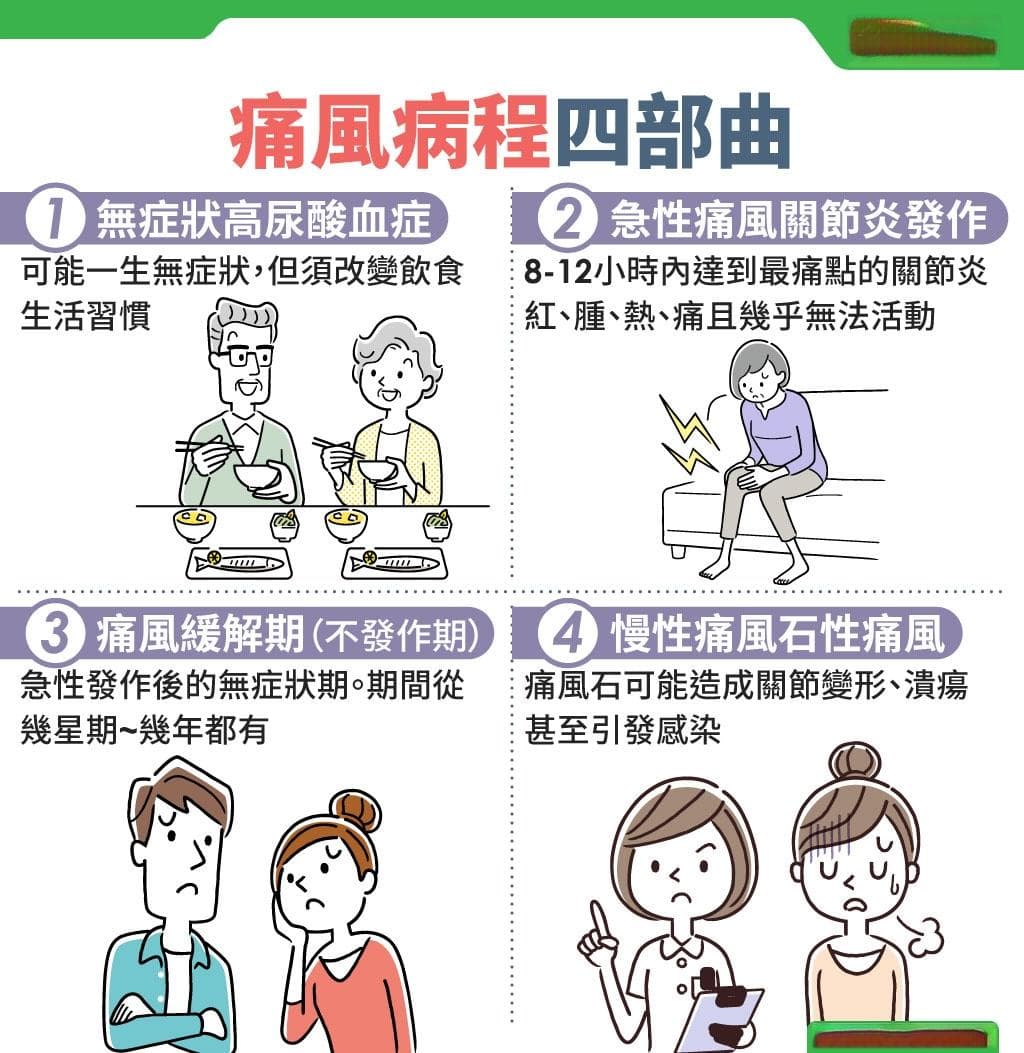 痛风症状怎么缓解？痛风4阶段、谁是高危险群一次看