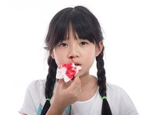 中药导致儿童鼻出血的五大原因及应对方法