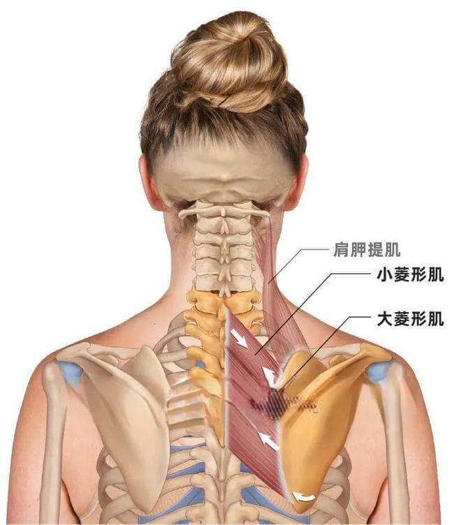 【每日一肌】翼状肩、上交叉综合征，还有肩胛骨内侧缘疼痛！
