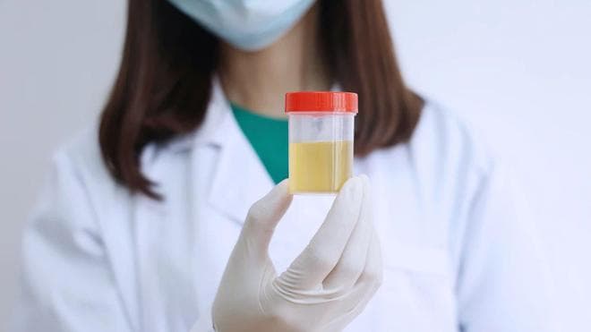 尿液发黄异味重？可能是这几大因素所致，这些情况需警惕