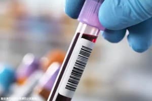 落枕后的正确恢复方法，这四个方法三分钟帮你缓解疼痛