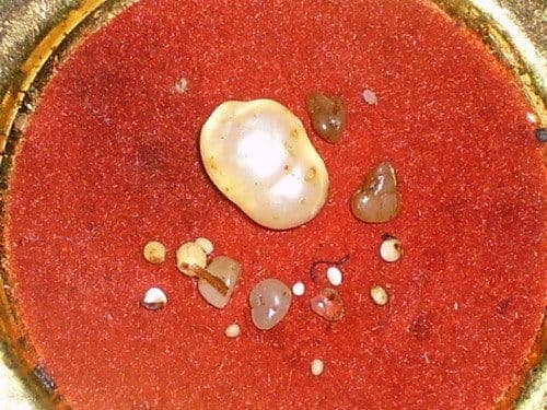 揭秘舍利子：神秘宗教遗物的形成之谜