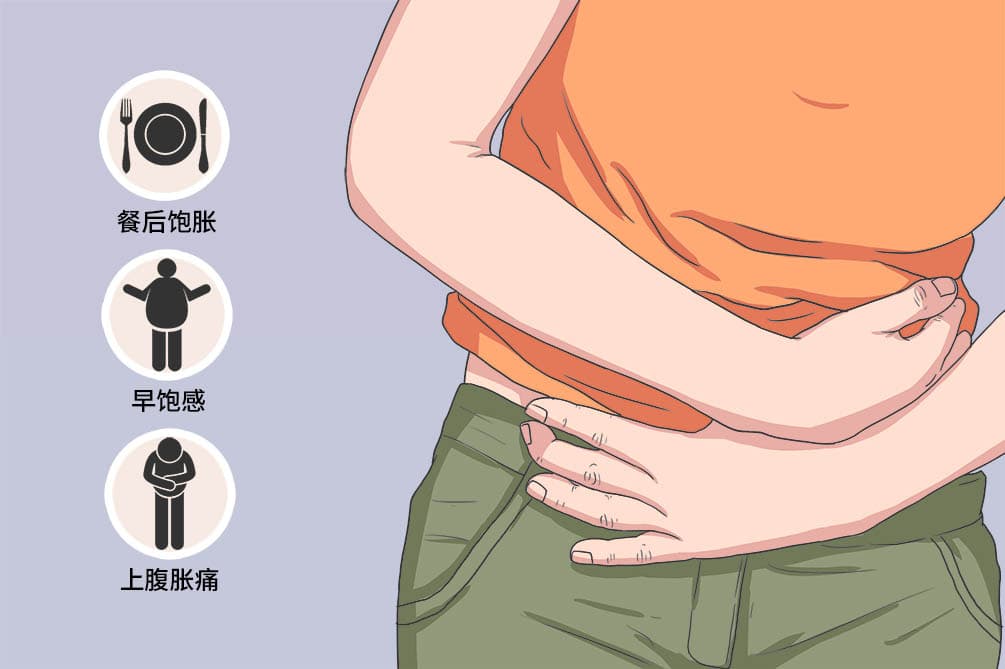 非溃疡性消化不良
