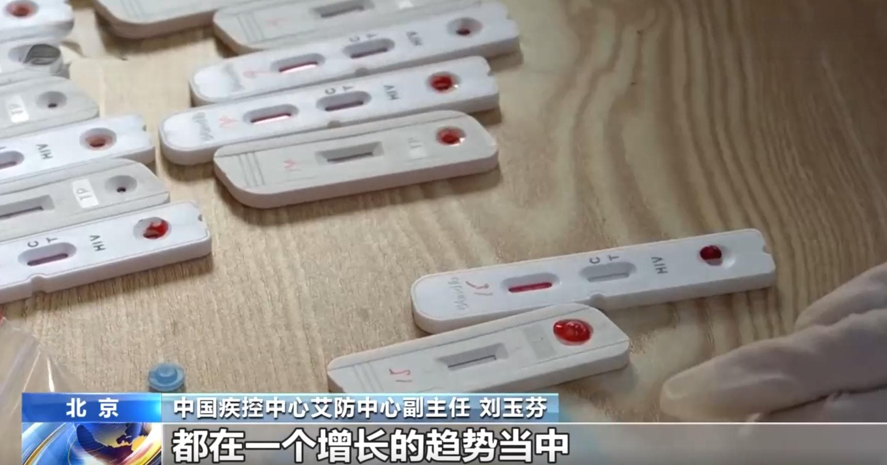 世界艾滋病日：我国疫情控制向好，但性传播仍需警惕