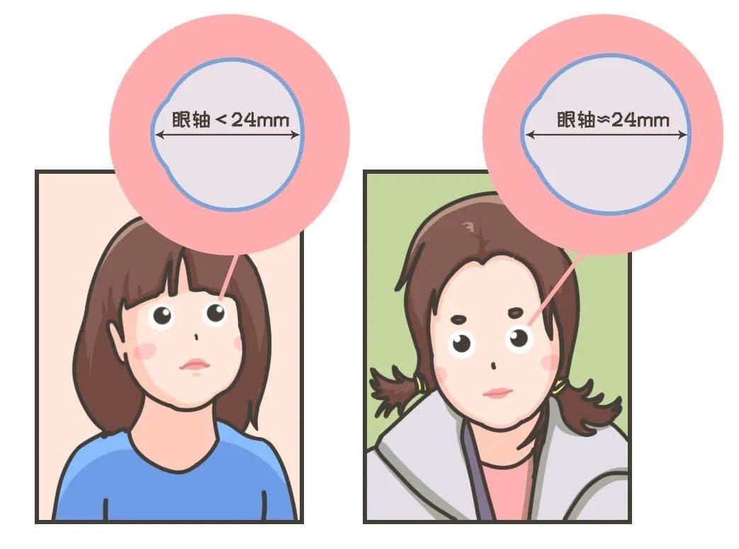 孩子近视后是否需要佩戴眼镜？这份专业建议请收好
