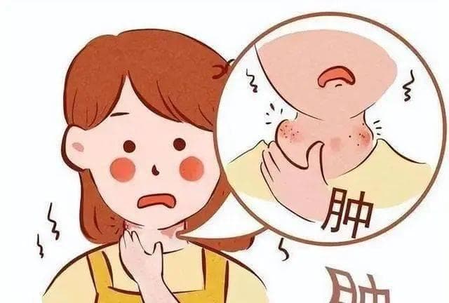 身体“小守卫”淋巴结：肿大背后的健康警示与癌症预警