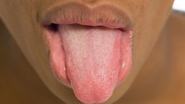腹泻专业联合用药注意什么？腹泻的表现症状和常见病因