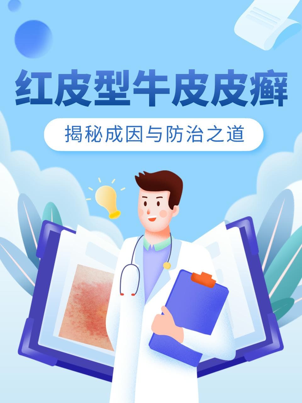 红皮型牛皮皮癣：揭秘成因与防治之道