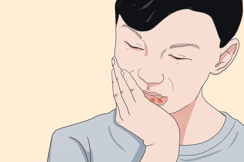 唇疱疹的成因及日常注意事项