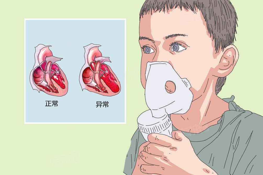 嘴唇有点紫是什么原因引起的