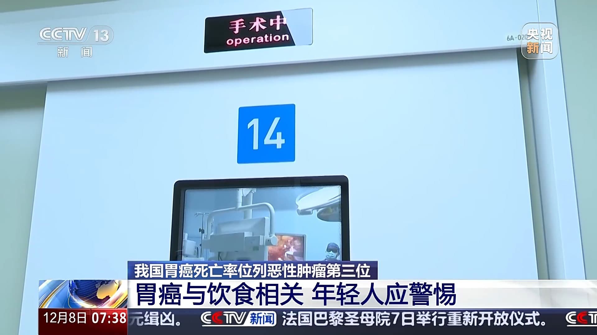 长期这么吃胃癌发病率增加！医生：年轻人要警惕