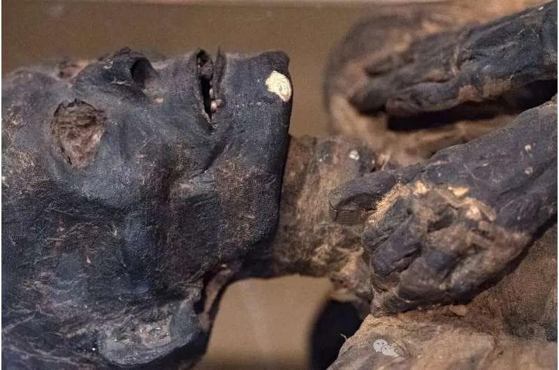 木乃伊研究：古代人得冠心病的概率也很高