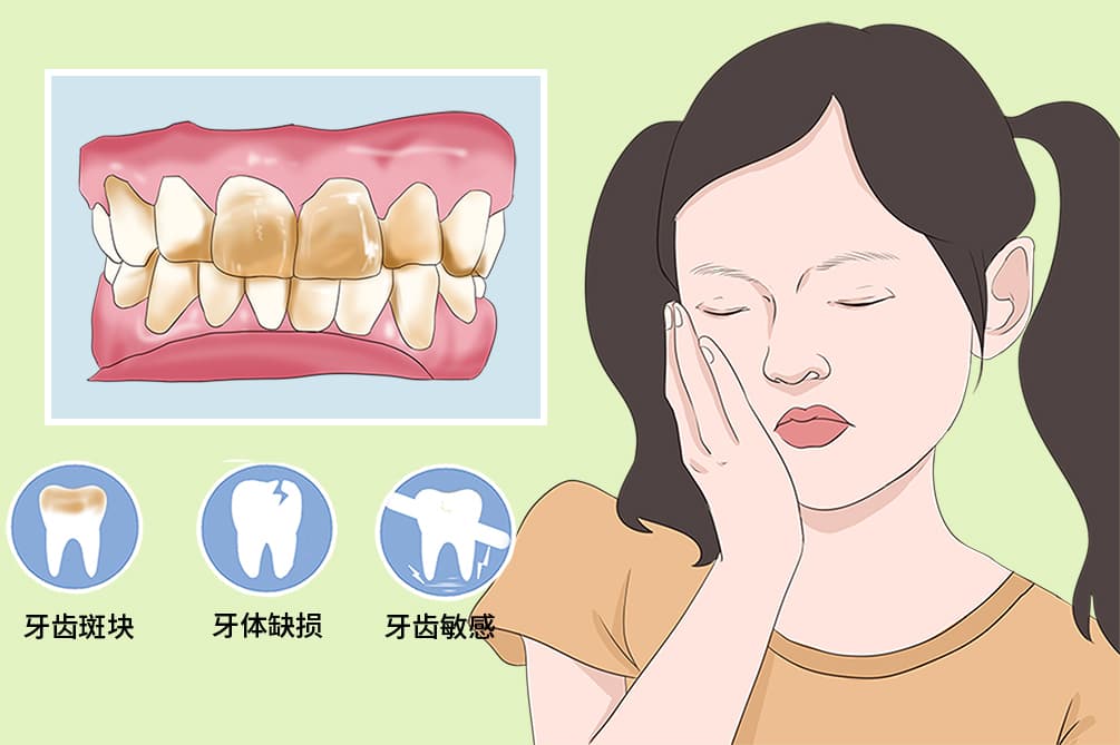 氟斑牙怎么治疗要花多少钱