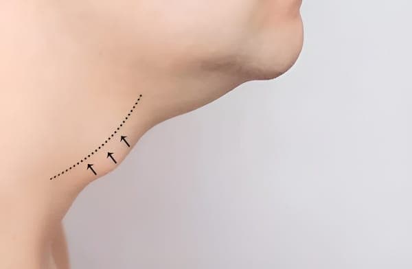 男孩子长喉结会影响身高吗？揭秘青春期发育的关键因素