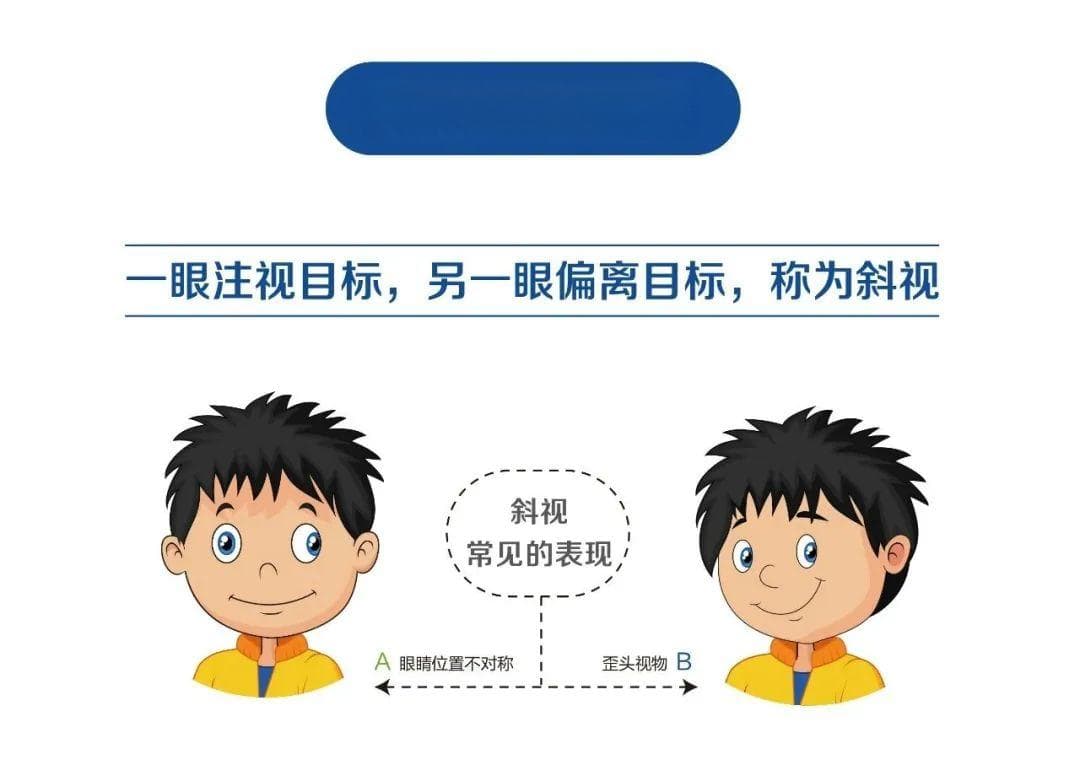 斜视的早期识别与治疗：从症状观察到专业干预