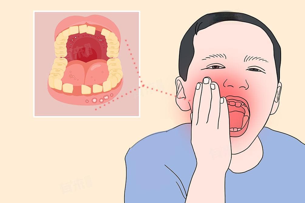 牙齿为什么会有炎症？