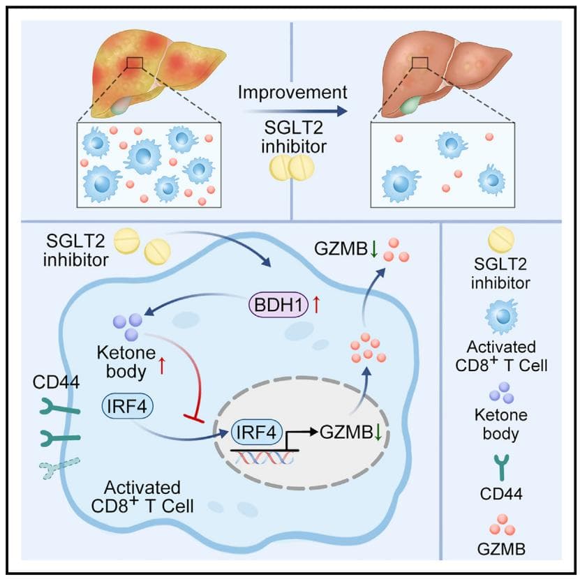 南方医科大学最新研究：恩格列净通过调节CD8+ T细胞生酮作用改善MASH
