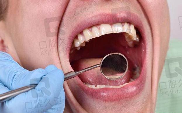 口里总是爱长泡？当心这5种口腔疾病！