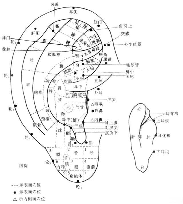【中医适宜技术】耳穴压豆