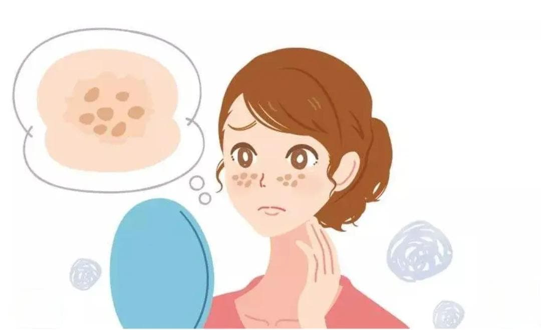 正确认识“老年斑”——脂溢性角化病