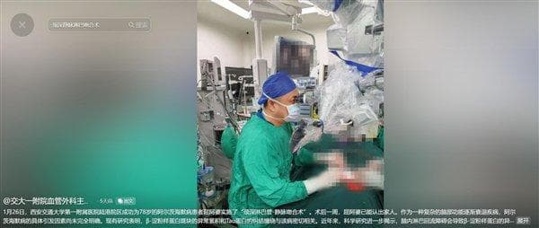阿尔茨海默病可以手术治疗了：手术费用不到两万元