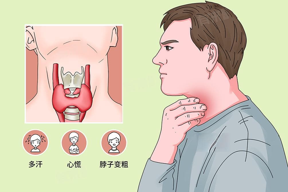 甲亢的治疗方法有几种