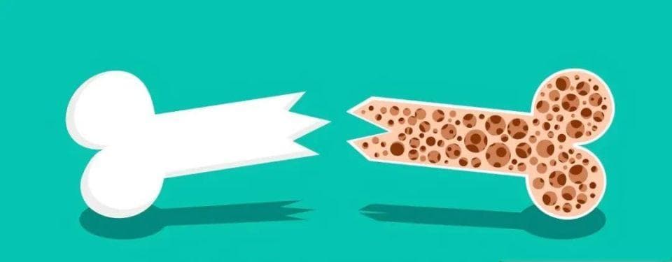4种疼痛可能是「骨质疏松」的信号