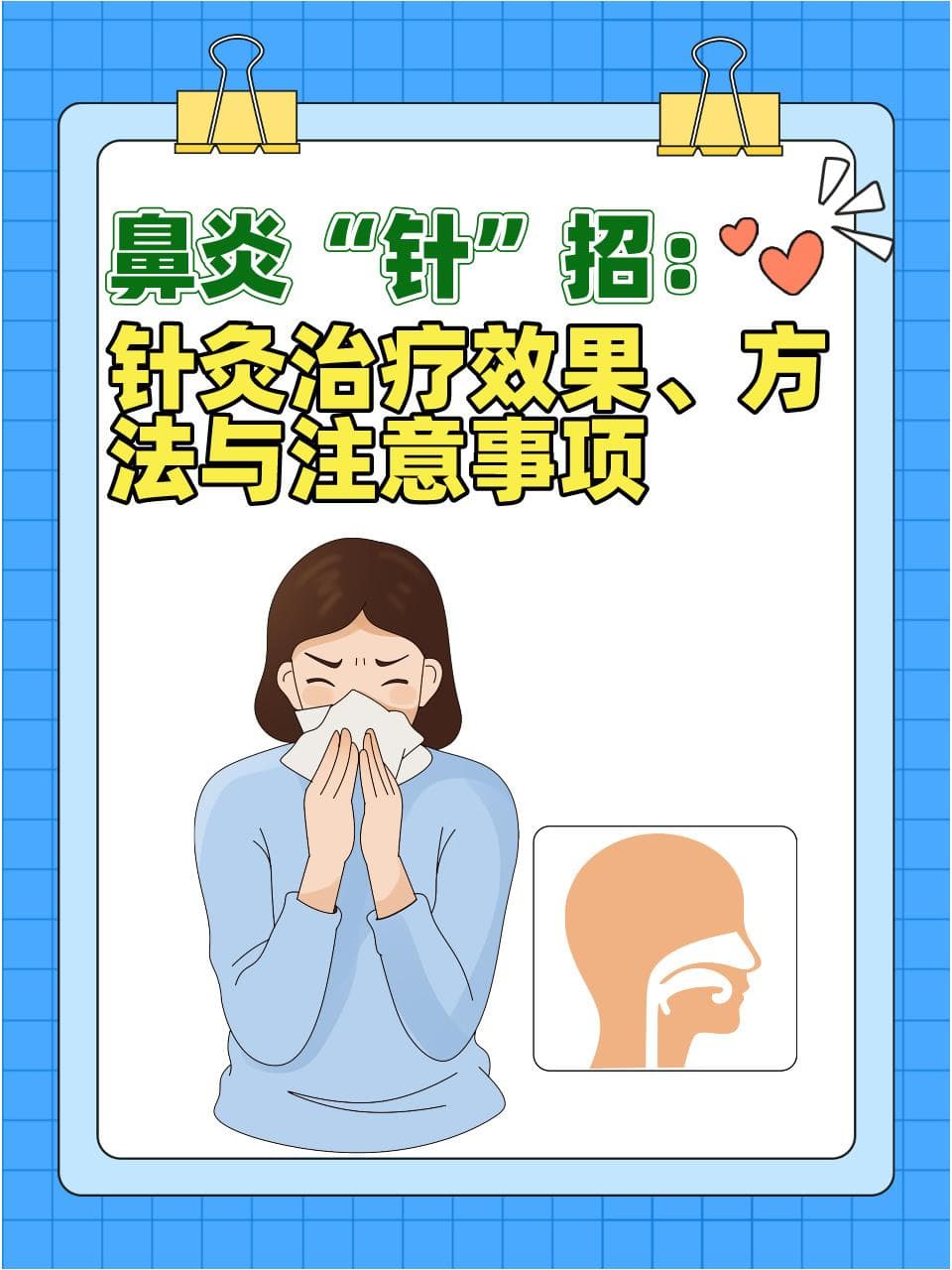 鼻炎“针”招：针灸治疗效果、方法与注意事项