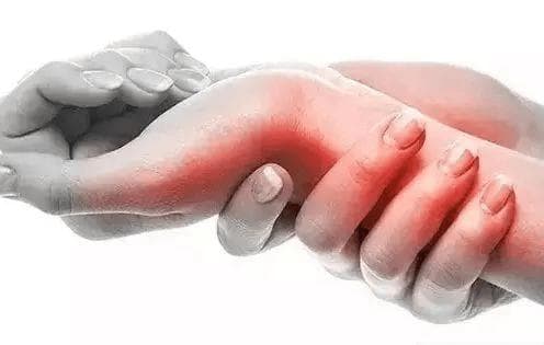 中医妙手回春：探索腱鞘炎的治愈之道