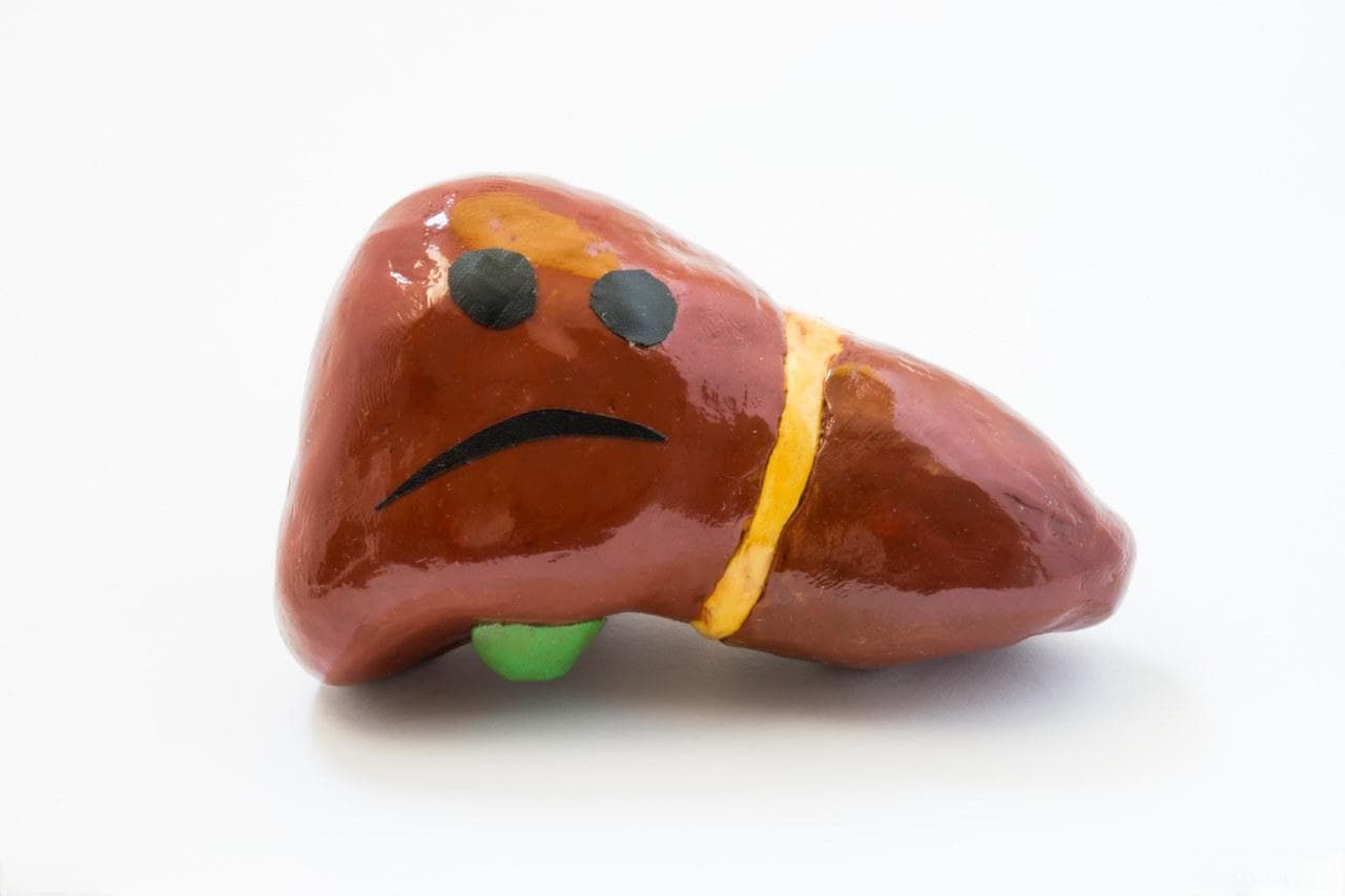 胆汁性肝硬化生存期