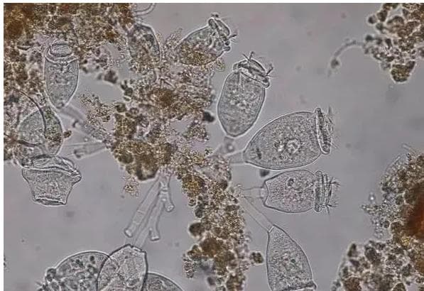污水处理中的微生物都有哪些？污水中如何营造微生物生长环境