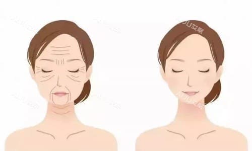 胶原蛋白流失垮脸怎么补？可通过医美/运动及食疗改善，而医美改善更快