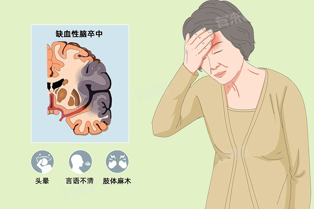 急性脑梗死黄金救治时间：4.5小时内的生死时速