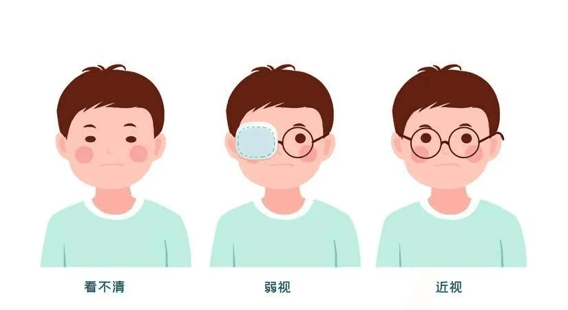 两只眼睛度数相差 100 度以上，这个问题不容忽视！
