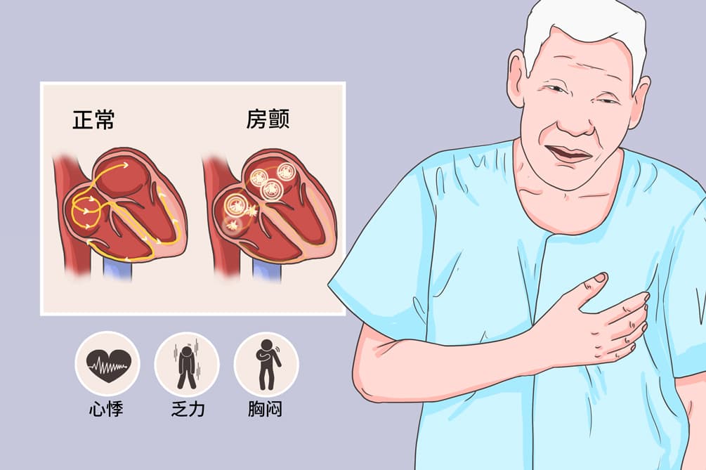 房颤的心率特征与治疗目标