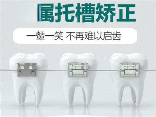 整牙十年后的感受：一位患者的真情实感分享