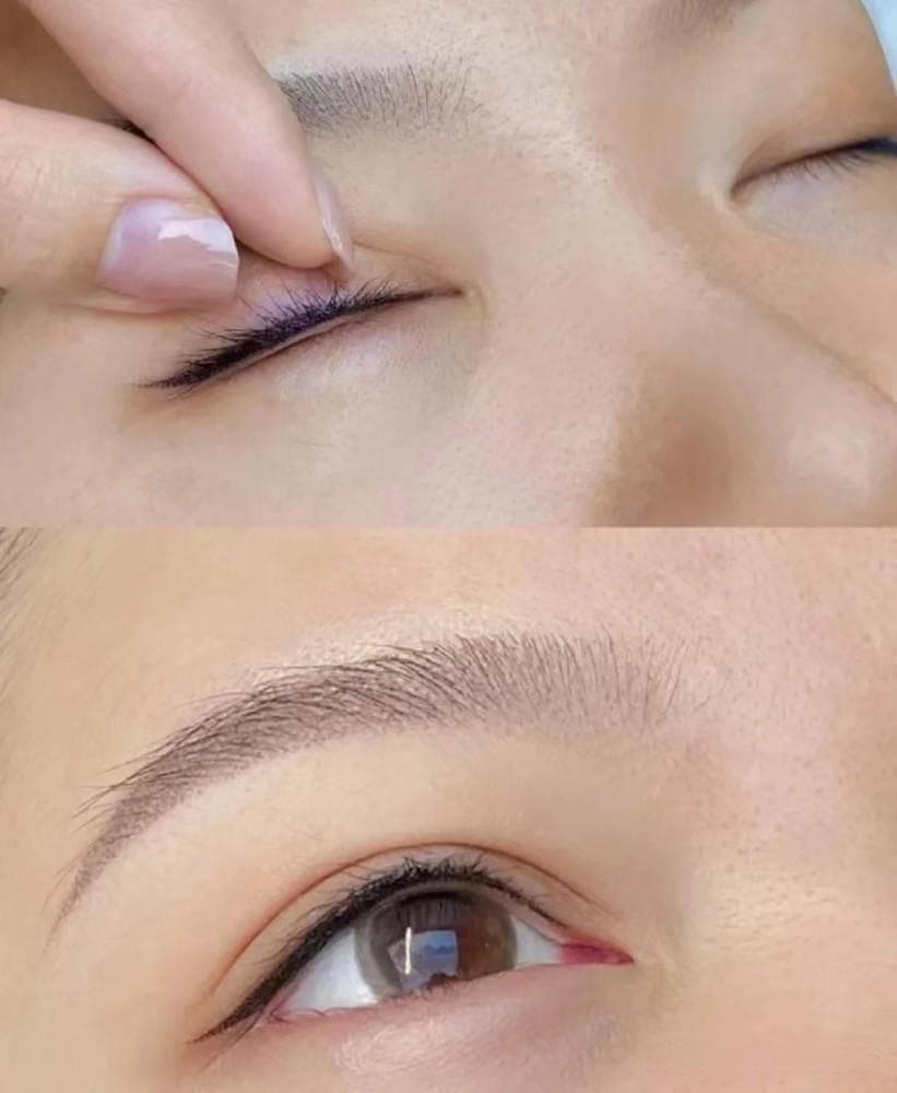 纹美瞳线恢复期：隐形眼镜佩戴时机与护理指南
