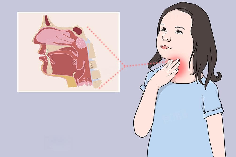 一般生什么病才吃头孢